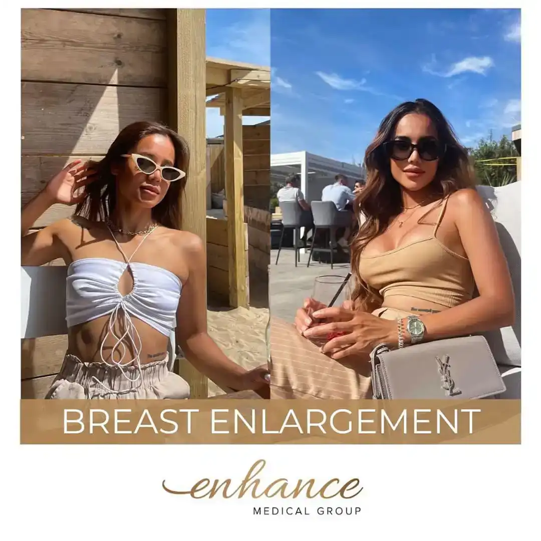 Breast Enlargement Birmingham Before and After