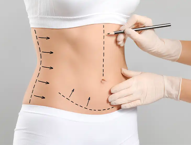 Is Liposuction Safe? A Guide to Safe Liposuction & Common Myths